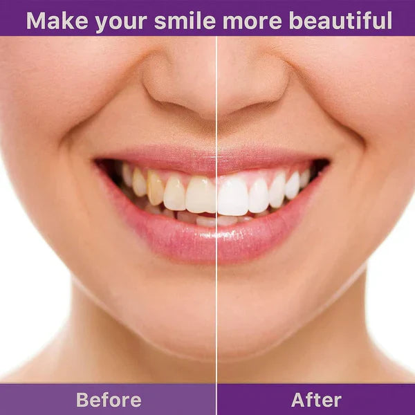 HiSmile V34 Teeth Whitening Serum