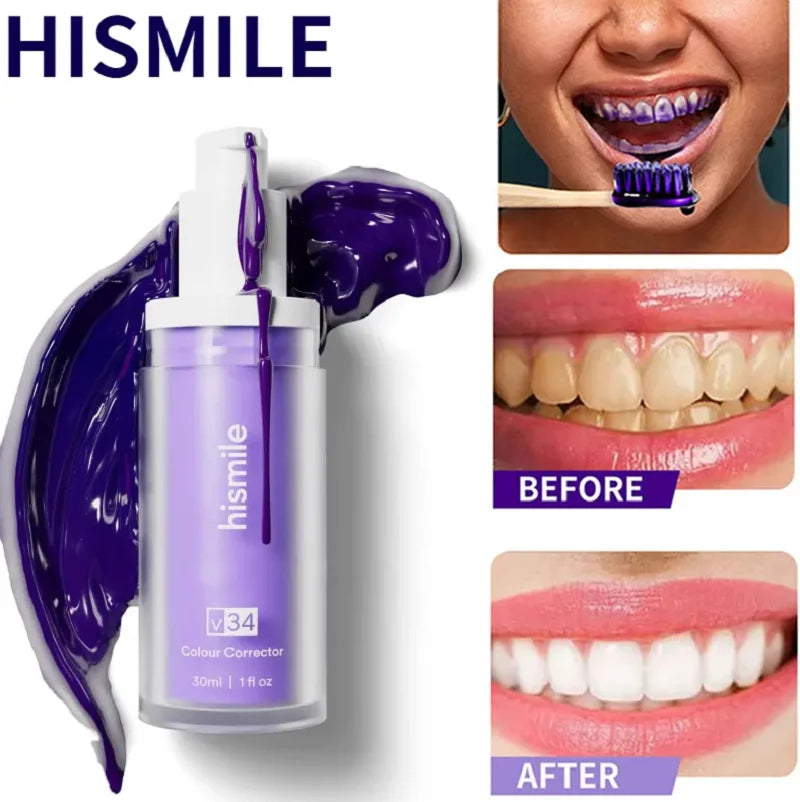 HiSmile V34 Teeth Whitening Serum