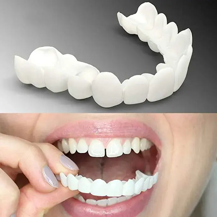 Instant Smile Reusable Snap On Veneers (Upper & Lower)