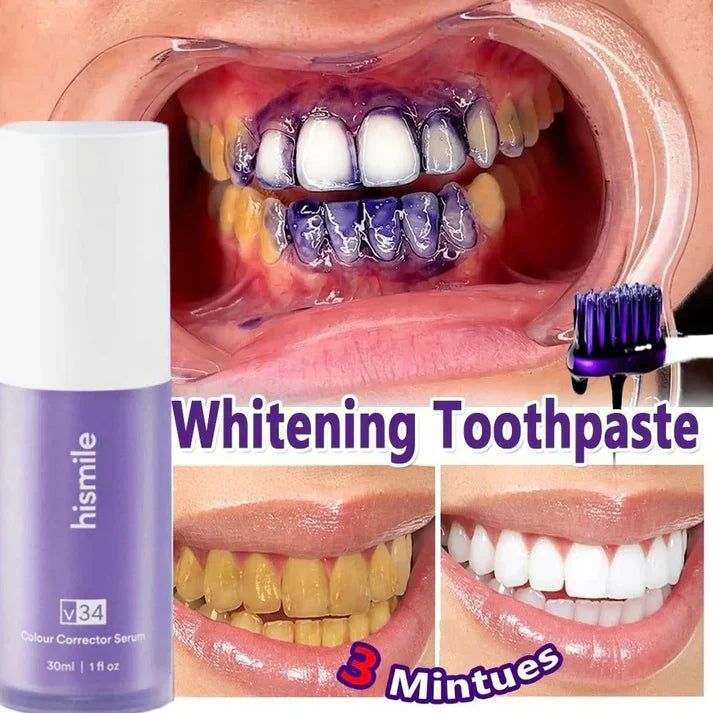 HiSmile V34 Teeth Whitening Serum