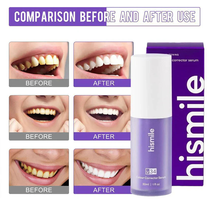 HiSmile V34 Teeth Whitening Serum